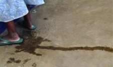 Leakage caused by fistula